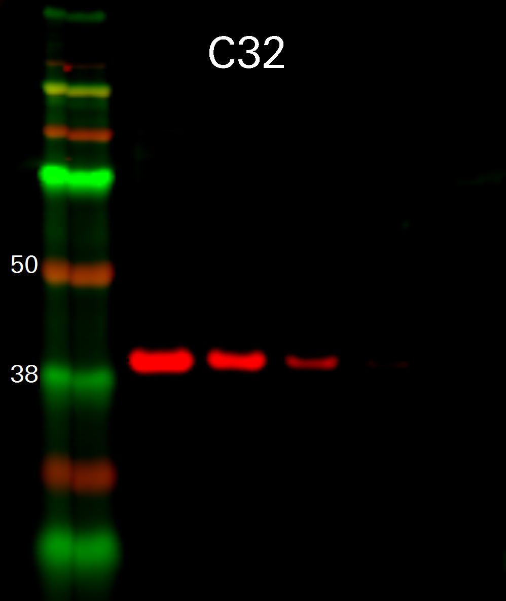 GAPDH Rabbit Monoclonal Antibody detected in C32 cells