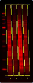 Revert Total Protein Stain lane boxes